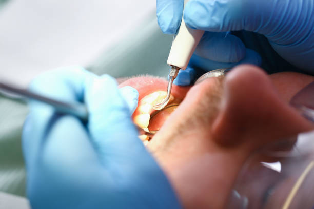 Best Emergency Dentist for Lost Fillings or Crowns in Kennedale, TX