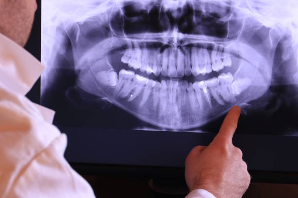 Best Emergency Dentist for Knocked-Out Tooth in Kennedale, TX