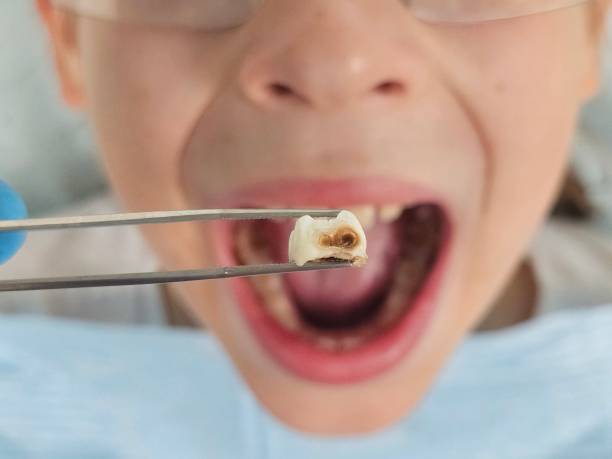 Best Emergency Dental Services for Seniors in Kennedale, TX